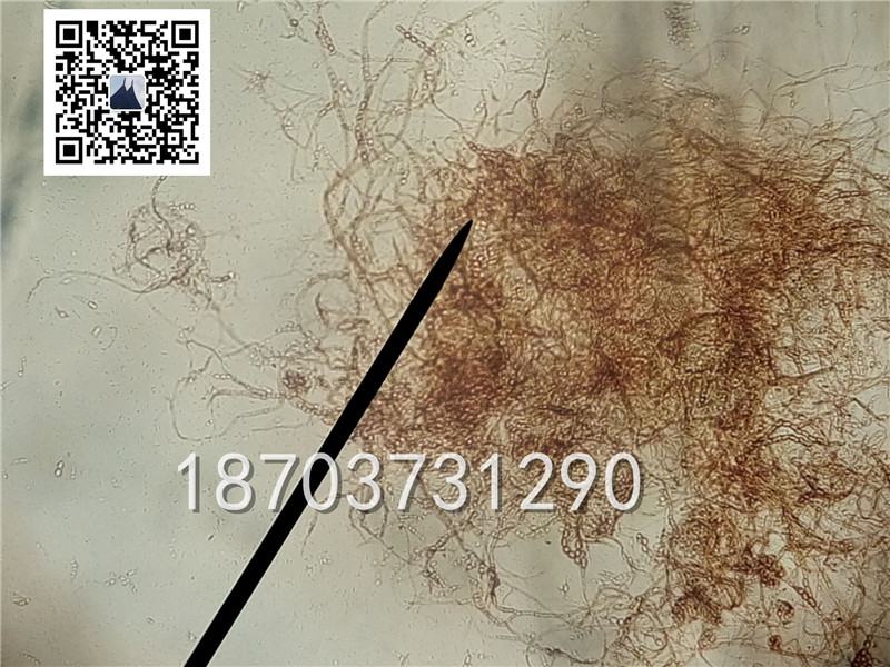 厚垣孢子(黃瓜枯萎病菌)